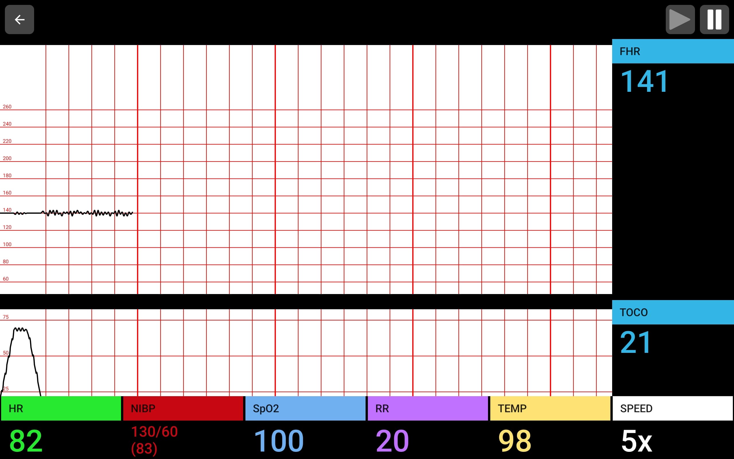 Fetal Heart Monitor student interface showing FHR tracing, TOCO contraction pattern, and maternal vitals bar