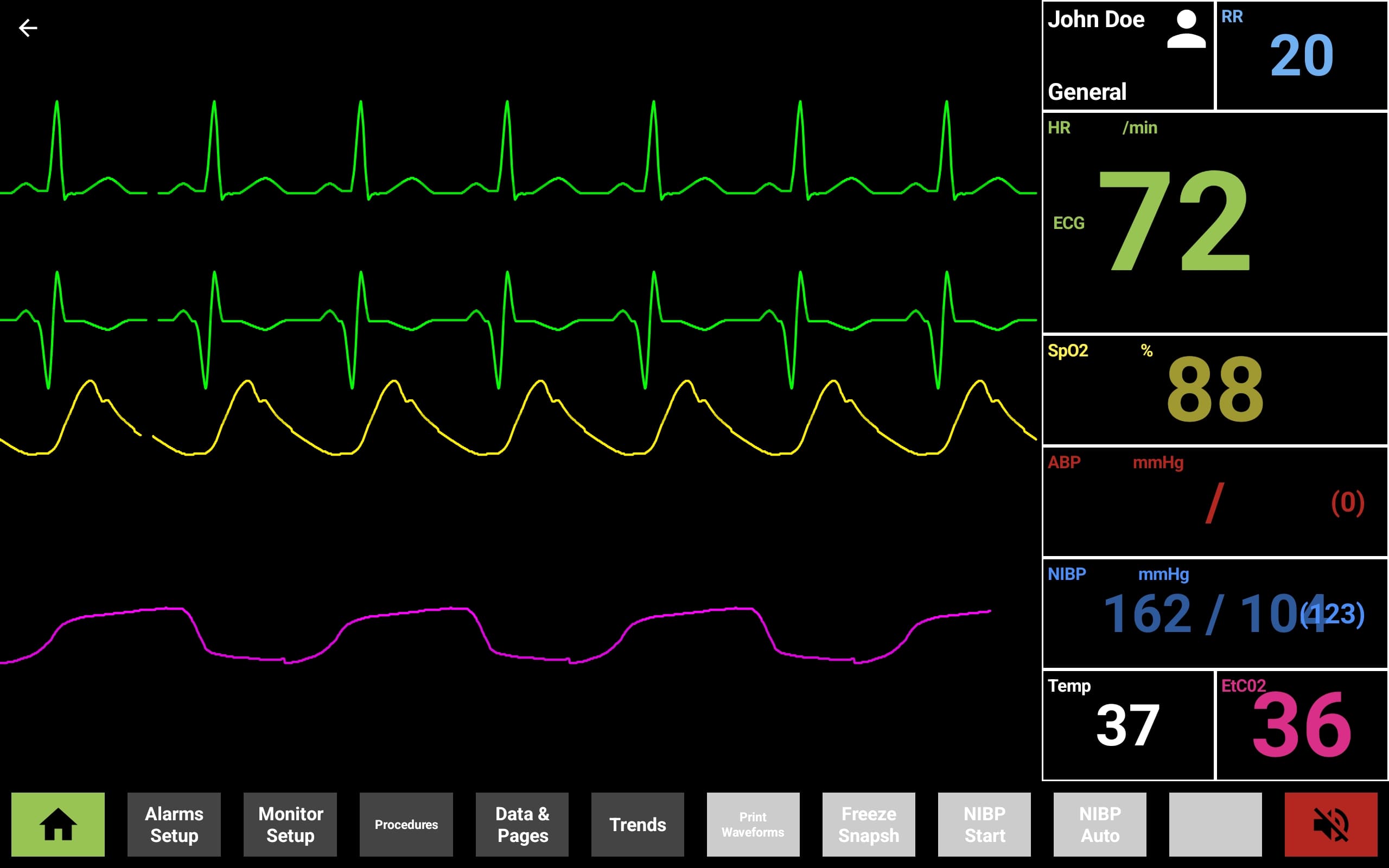 Student hospital monitor running with ECG, SpO2, and capnography waveforms and live vitals
