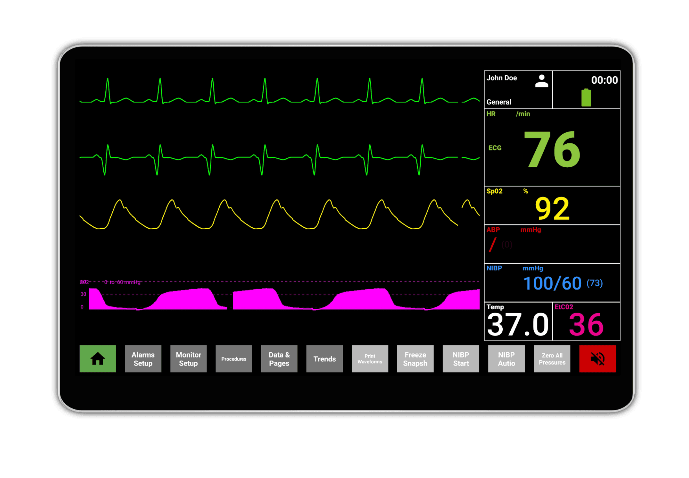 Hospital Monitor