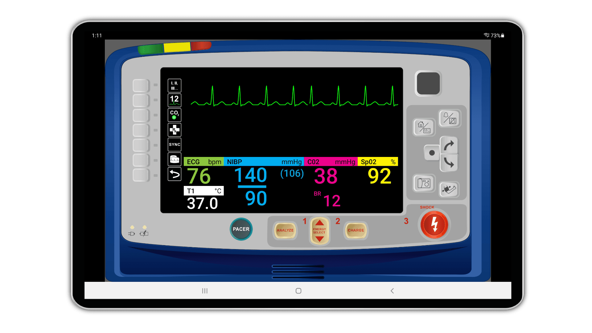 SimVS X Series layout simulation screen