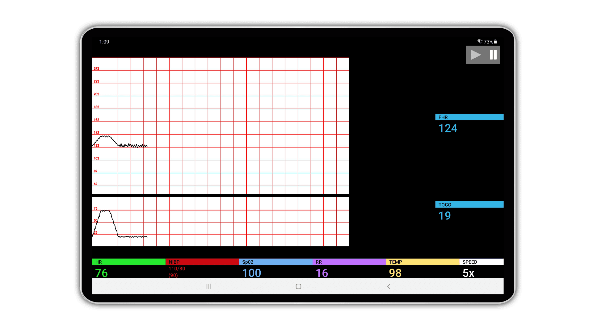 SimVS Fetal Heart Monitor simulation screen