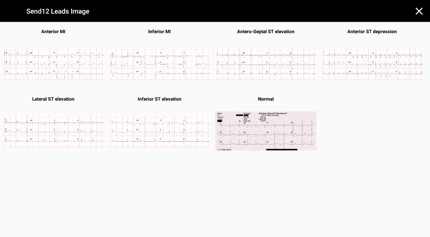 Send 12 Leads Image dialog showing 7 EKG variants: Anterior MI, Inferior MI, Antero-Septal ST elevation, Anterior ST depression, Lateral ST elevation, Inferior ST elevation, and Normal