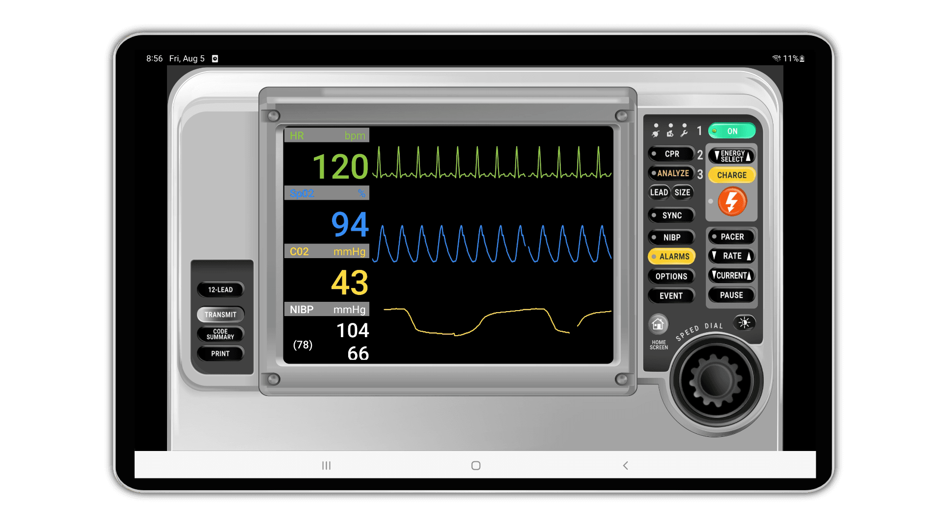 SimVS LP-15 Defibrillator interface showing waveforms, vital signs, control panel, and speed dial