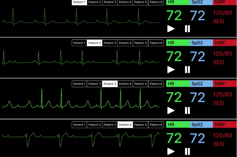 Telemetry student view showing 4 simultaneous patient cardiac rhythm strips with HR, SpO2, and NIBP values, each with individual patient tab selection