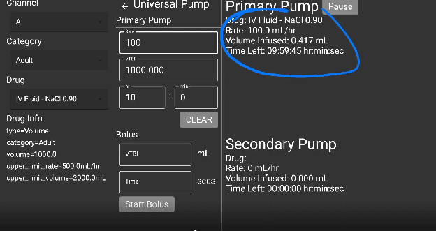 Universal pump with Primary Pump running and highlighted status display showing volume infused and time remaining