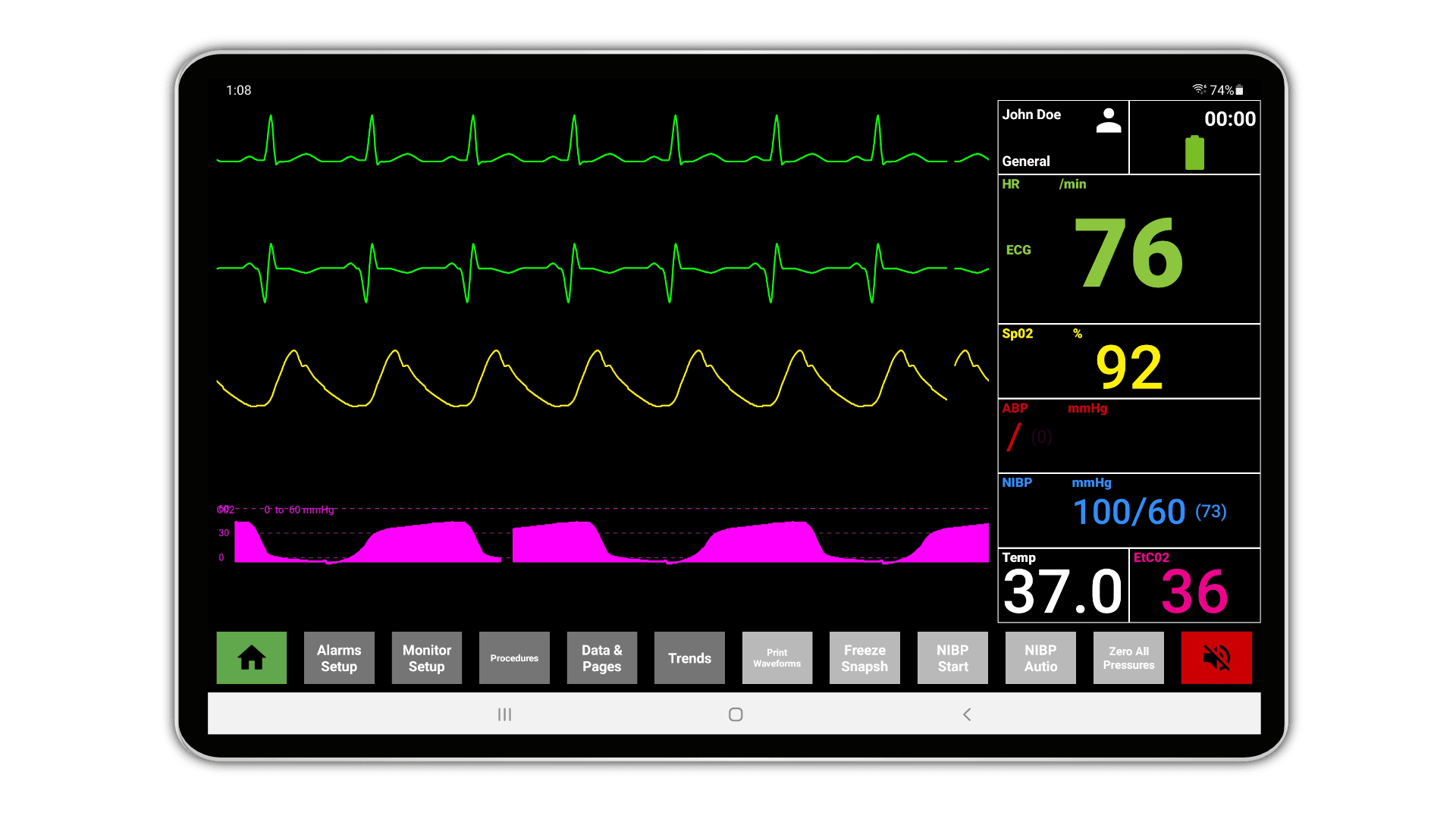 Hospital Monitor Display