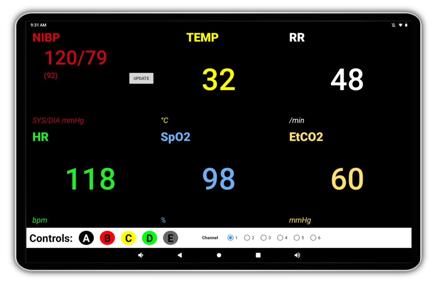 Vital Signs Monitor