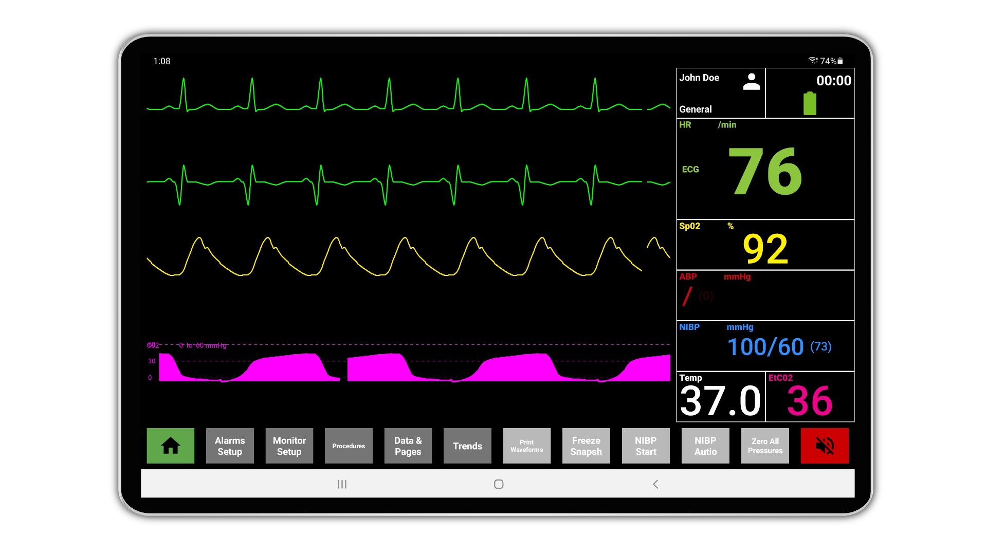 SimVS puts real device interfaces on a tablet at the bedside, no headset required.